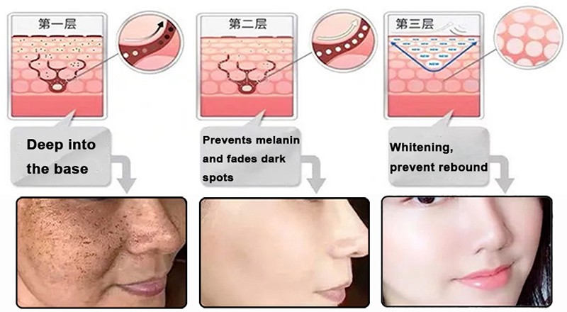 Symwhite Whitening Symwhite Whitening